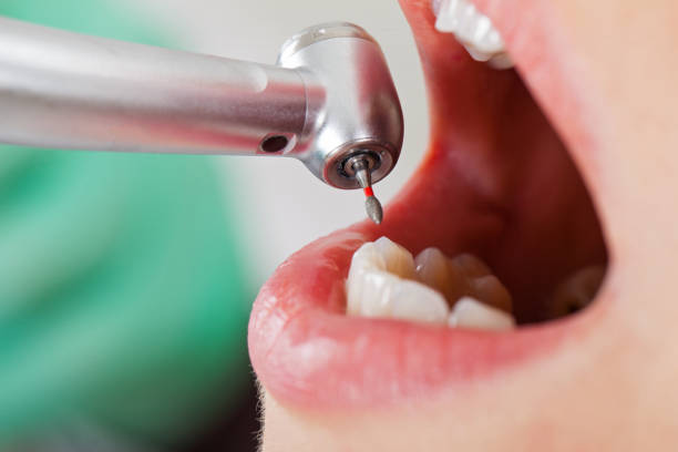 Best Emergency Dentist for Knocked-Out Tooth in Brownstown, PA